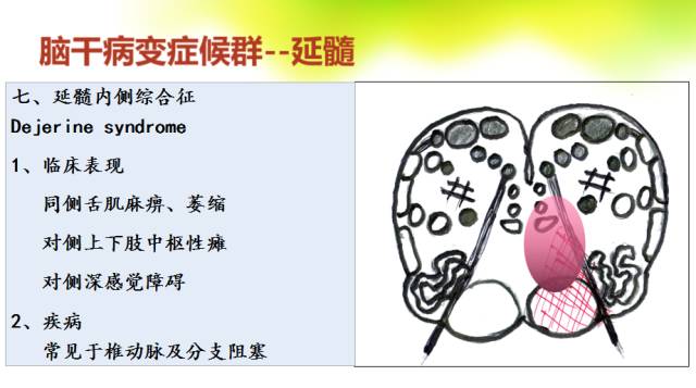【PPT】脑干影像解剖及诊断