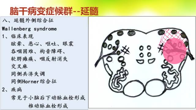 【PPT】脑干影像解剖及诊断