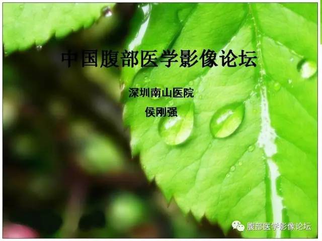 【病例】回肠淋巴瘤并肠套叠1例CT 【病例】回肠淋巴瘤并肠套叠1例CT