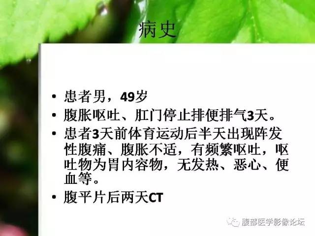 【病例】回肠淋巴瘤并肠套叠1例CT