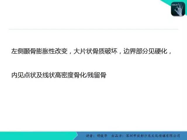 【PPT】颅面骨巨细胞修复性肉芽肿的影像诊断