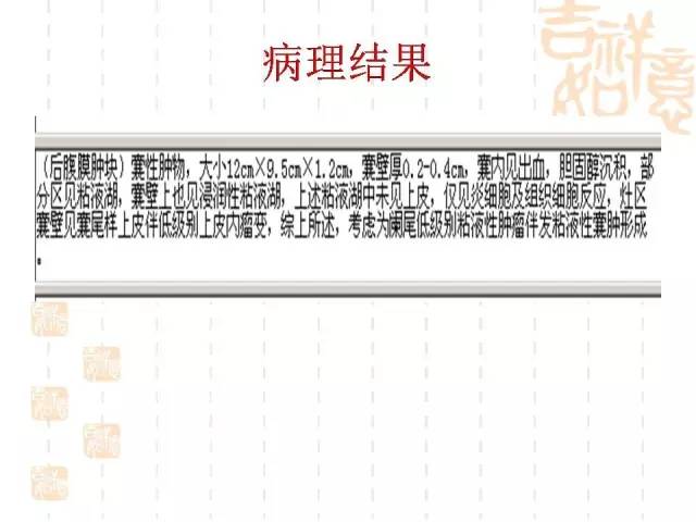 【病例】阑尾粘液性肿瘤2例影像诊断与鉴别