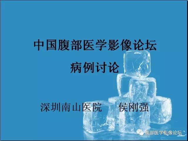 【病例】腹膜后副神经节瘤1例CT影像表现 【病例】腹膜后副神经节瘤1例CT影像表现