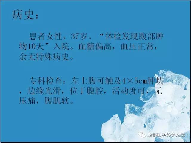 【病例】腹膜后副神经节瘤1例CT影像表现