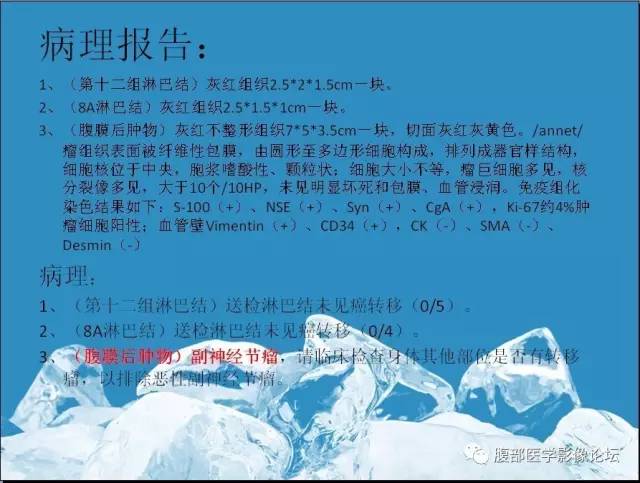 【病例】腹膜后副神经节瘤1例CT影像表现 【病例】腹膜后副神经节瘤1例CT影像表现