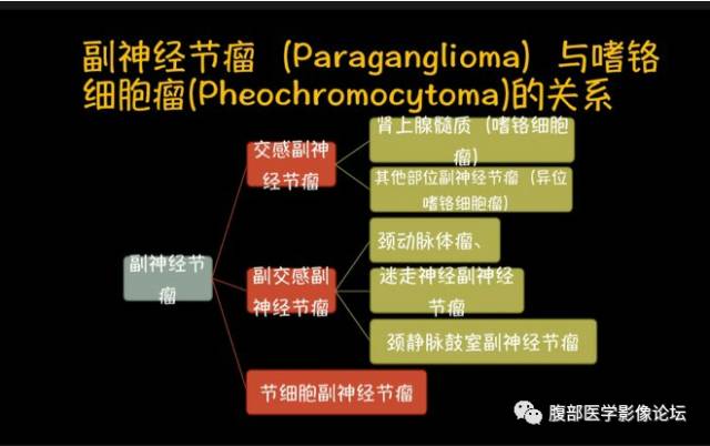 【病例】腹膜后副神经节瘤1例CT影像表现 【病例】腹膜后副神经节瘤1例CT影像表现