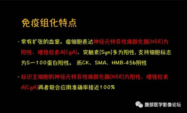【病例】腹膜后副神经节瘤1例CT影像表现 【病例】腹膜后副神经节瘤1例CT影像表现