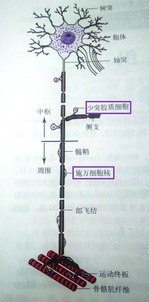 常被误诊为颅内肿瘤的脱髓鞘假瘤 常被误诊为颅内肿瘤的脱髓鞘假瘤