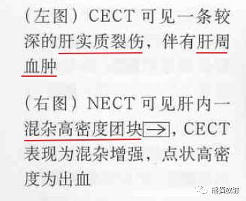 【书摘】“伴有出血的局部肝损害”之鉴别诊断
