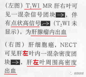 【书摘】“伴有出血的局部肝损害”之鉴别诊断