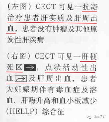 【书摘】“伴有出血的局部肝损害”之鉴别诊断