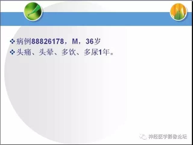 【病例】CNS窦淋巴组织细胞增生伴巨淋巴结病1例MR