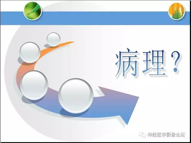 【病例】CNS窦淋巴组织细胞增生伴巨淋巴结病1例MR 【病例】CNS窦淋巴组织细胞增生伴巨淋巴结病1例MR