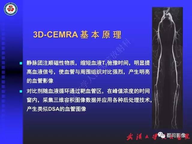 【PPT】下肢血管性病变CTA和MRA