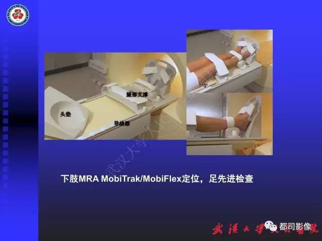 【PPT】下肢血管性病变CTA和MRA