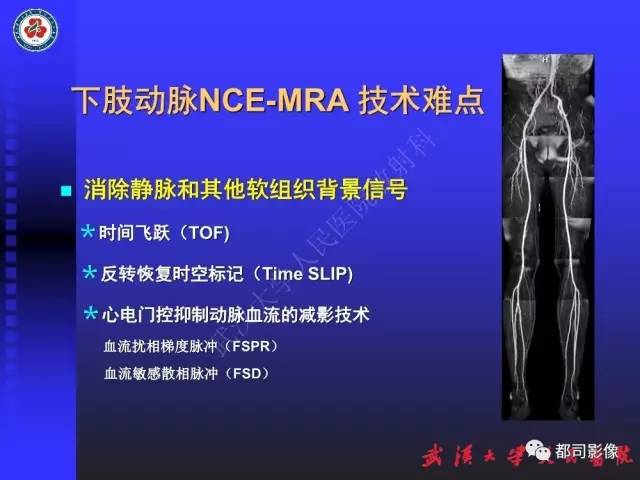 【PPT】下肢血管性病变CTA和MRA