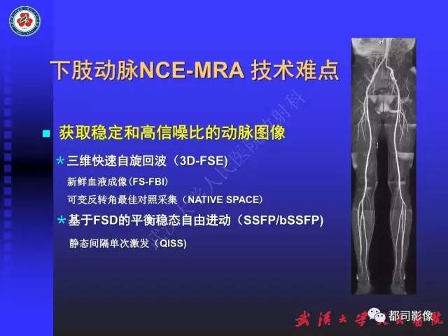【PPT】下肢血管性病变CTA和MRA