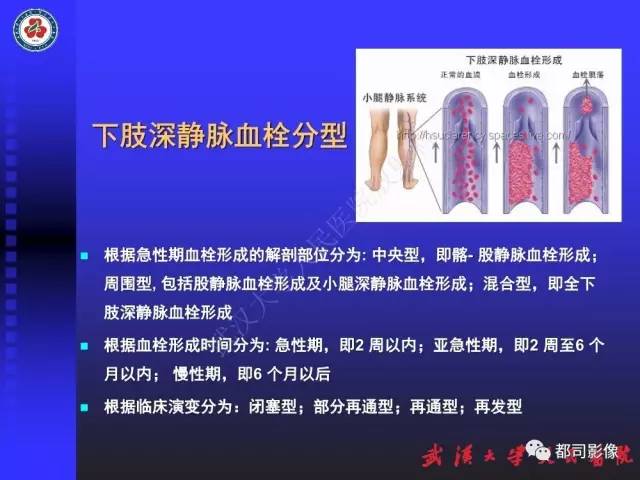 【PPT】下肢血管性病变CTA和MRA