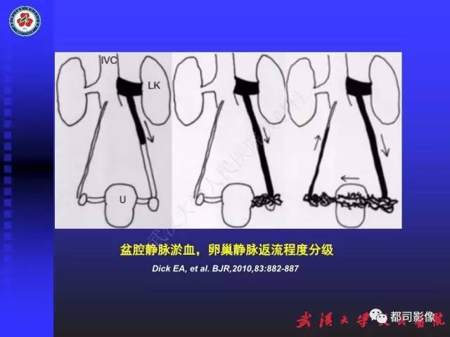 【PPT】下肢血管性病变CTA和MRA