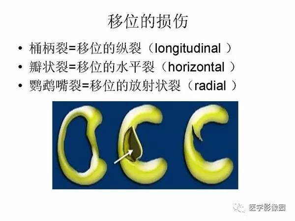 【PPT】半月板的影像学表现