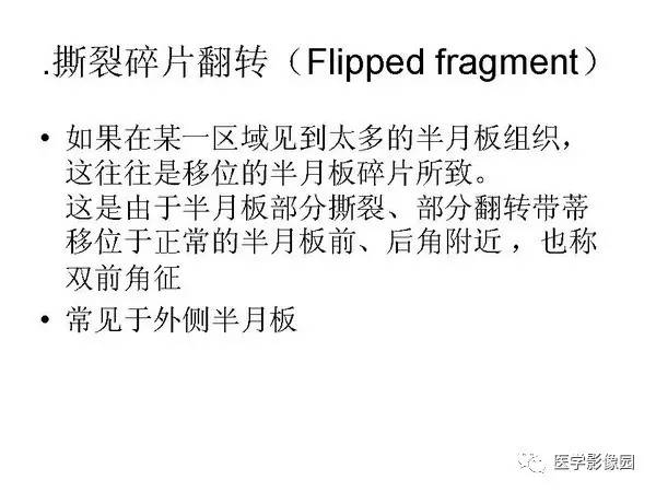 【PPT】半月板的影像学表现