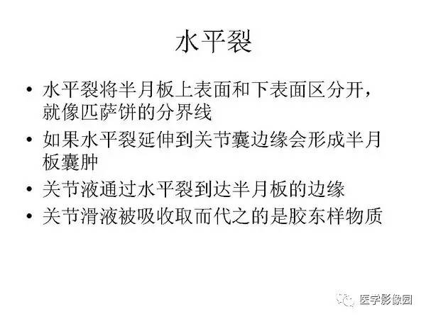 【PPT】半月板的影像学表现