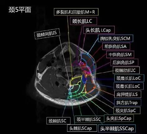 正常颈椎肌肉 MRI 横断位及三维重建图 正常颈椎肌肉 MRI 横断位及三维重建图