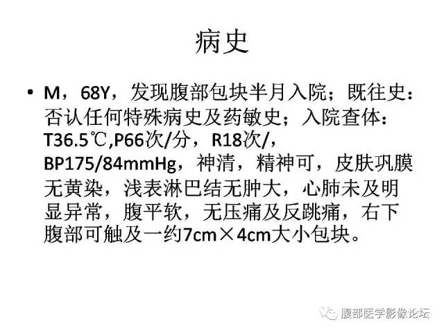 【病例】阑尾粘液囊肿1例CT影像表现