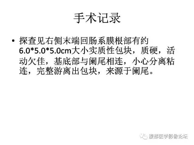 【病例】阑尾粘液囊肿1例CT影像表现