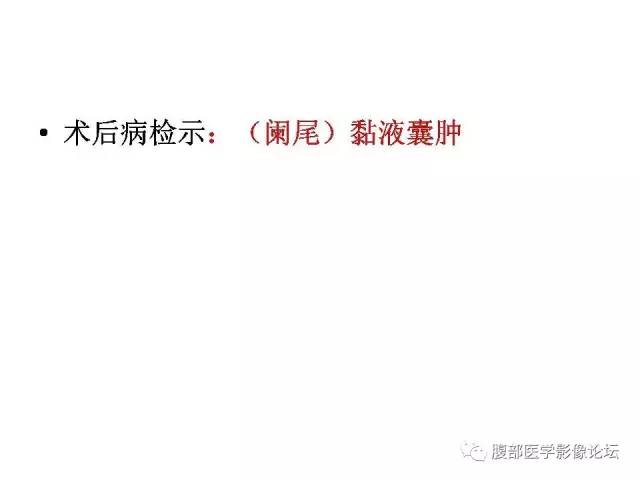 【病例】阑尾粘液囊肿1例CT影像表现