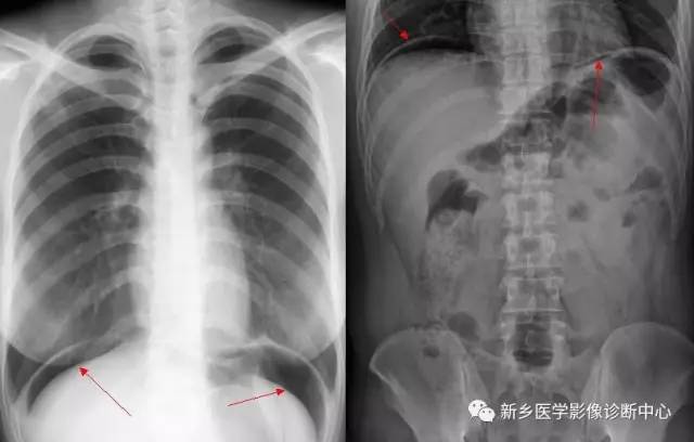 值夜班必须掌握的21种腹部疼痛原因 值夜班必须掌握的21种腹部疼痛原因