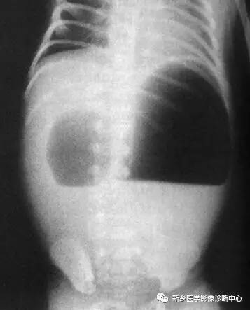 值夜班必须掌握的21种腹部疼痛原因 值夜班必须掌握的21种腹部疼痛原因