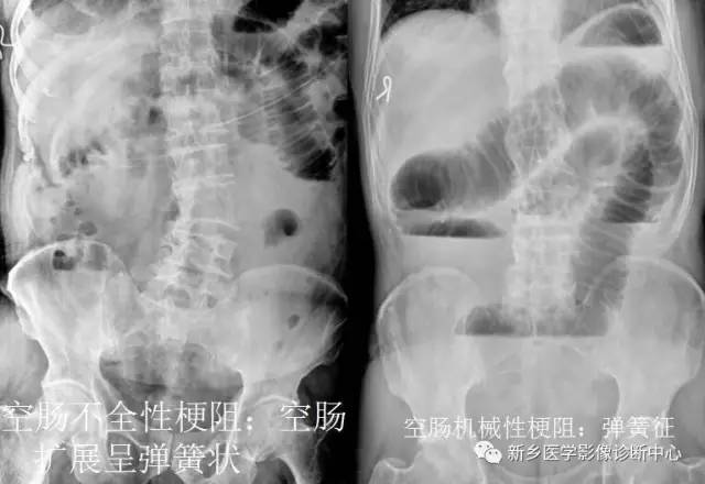 值夜班必须掌握的21种腹部疼痛原因 值夜班必须掌握的21种腹部疼痛原因