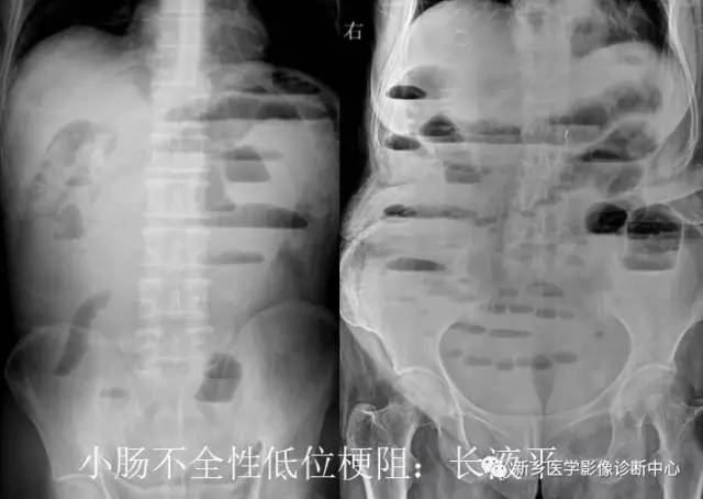 值夜班必须掌握的21种腹部疼痛原因 值夜班必须掌握的21种腹部疼痛原因