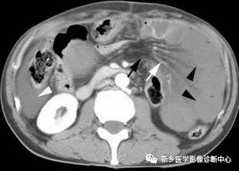 值夜班必须掌握的21种腹部疼痛原因 值夜班必须掌握的21种腹部疼痛原因