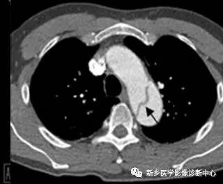 值夜班必须掌握的21种腹部疼痛原因 值夜班必须掌握的21种腹部疼痛原因