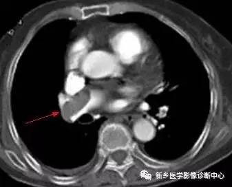 值夜班必须掌握的21种腹部疼痛原因 值夜班必须掌握的21种腹部疼痛原因