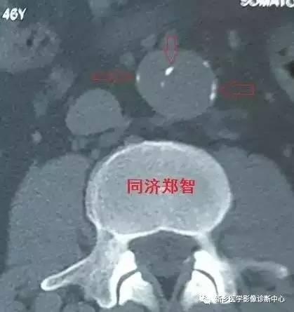 值夜班必须掌握的21种腹部疼痛原因 值夜班必须掌握的21种腹部疼痛原因