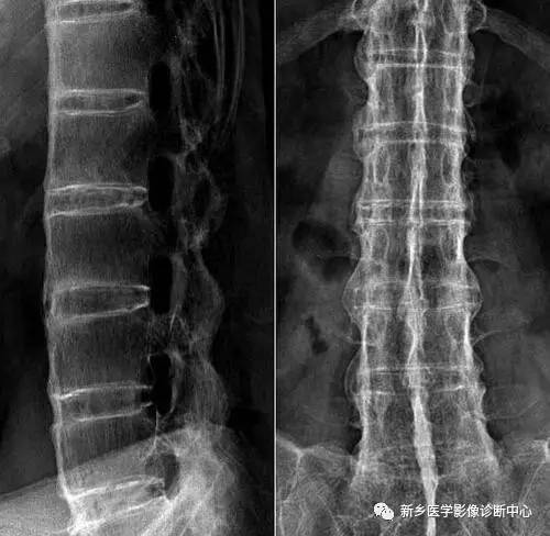 值夜班必须掌握的21种腹部疼痛原因 值夜班必须掌握的21种腹部疼痛原因