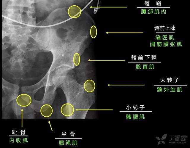 值夜班千万不要漏诊的36种骨折 值夜班千万不要漏诊的36种骨折