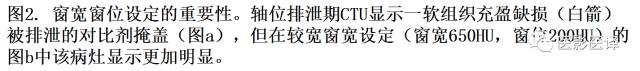 CT尿路造影在输尿管疾病的应用 CT尿路造影在输尿管疾病的应用
