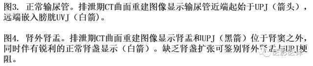 CT尿路造影在输尿管疾病的应用 CT尿路造影在输尿管疾病的应用