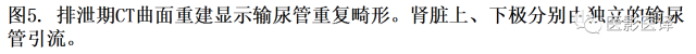 CT尿路造影在输尿管疾病的应用 CT尿路造影在输尿管疾病的应用