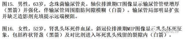 CT尿路造影在输尿管疾病的应用 CT尿路造影在输尿管疾病的应用