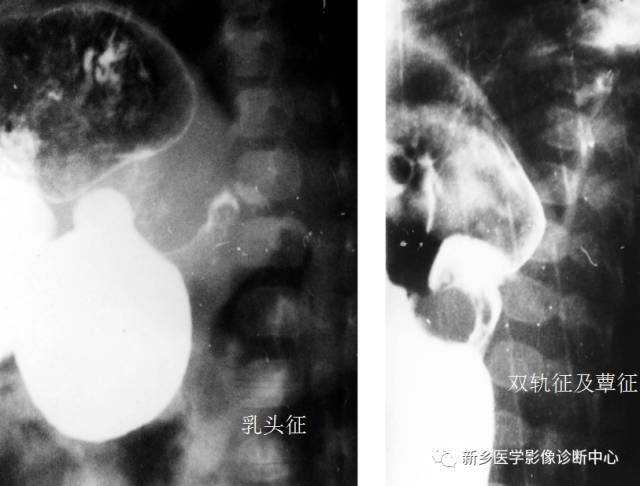 值夜班不能忽视的10种儿童腹痛原因 值夜班不能忽视的10种儿童腹痛原因