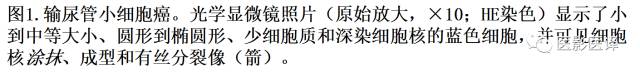 肺外小细胞癌：影像学特点及影像病理对照
