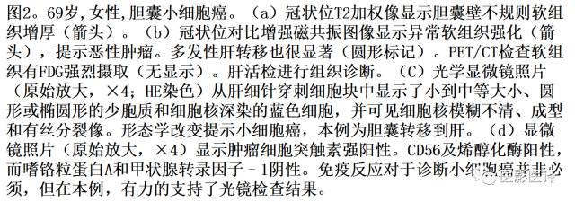肺外小细胞癌：影像学特点及影像病理对照