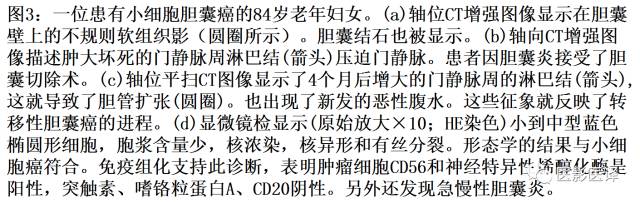 肺外小细胞癌：影像学特点及影像病理对照