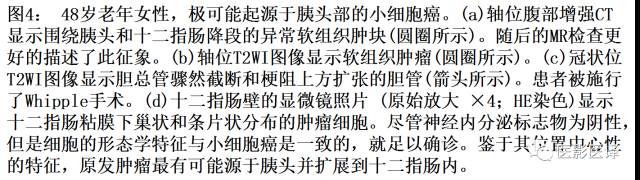 肺外小细胞癌：影像学特点及影像病理对照