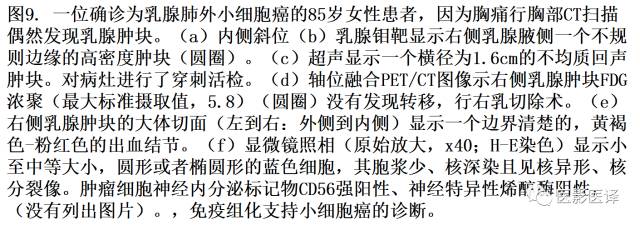 肺外小细胞癌：影像学特点及影像病理对照